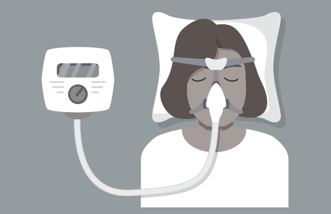 CPAP Maker Agrees to $479 Million Settlement Over Defects - The
