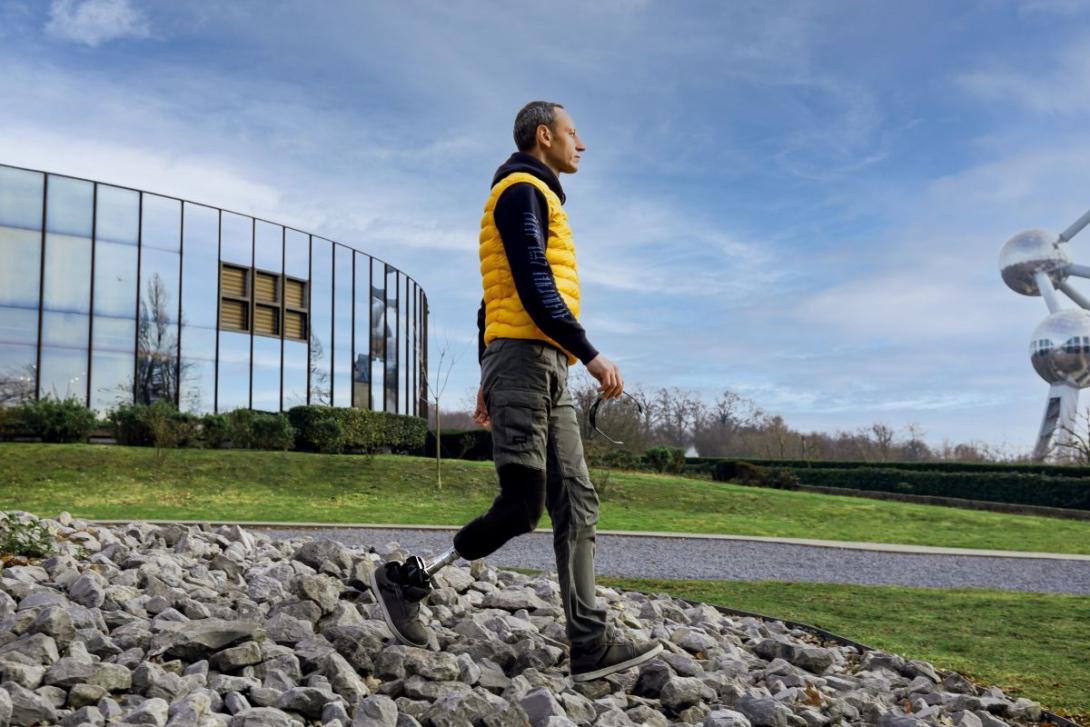 Man with foot prosthesis