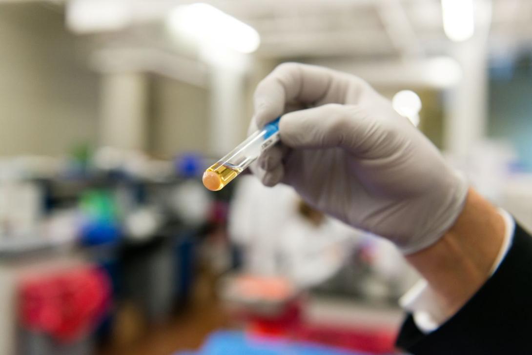 urine test A urine sample is displayed at the Comprehensive Pain Specialists laboratory.