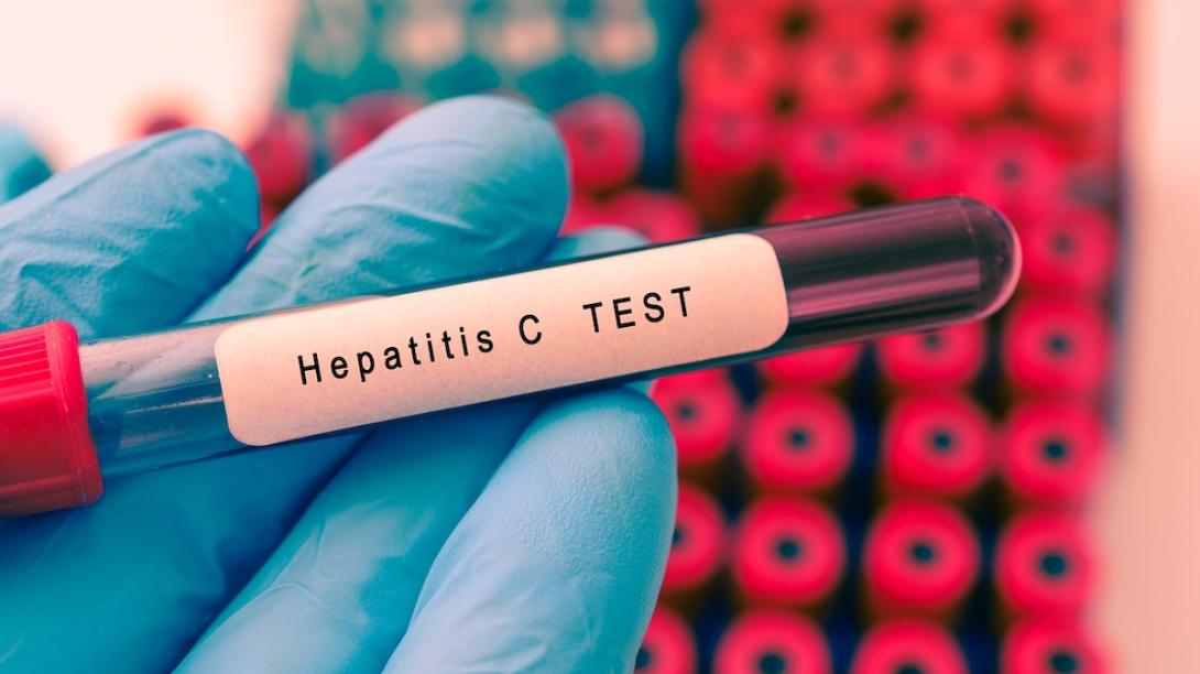 Hepatitis C test