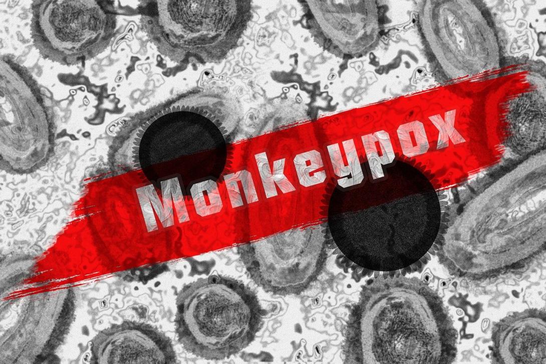 microscopic monkeypox virus 